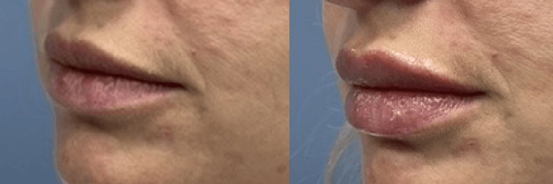 785 Aesthetic Med Spa