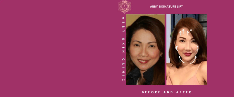 Abby Skin Clinic & FFMS Medspa