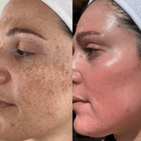 Amor Med Spa & Aesthetics