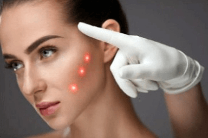 Aura Medical Lasers & Aesthetics