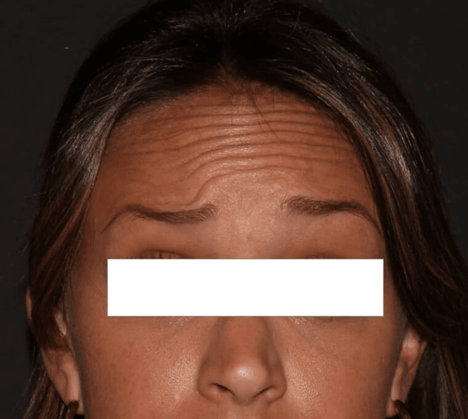 Awaken Med Spa of Clayton