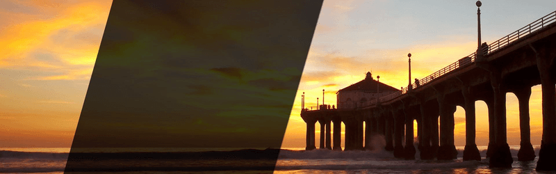 Beach Cities Vein and Laser Center