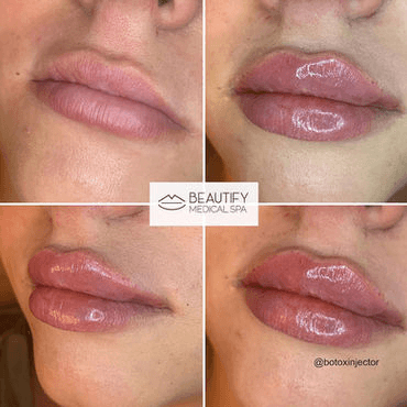 Beautify Medical Spa