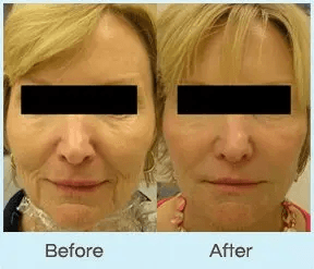 Center For Laser Surgery