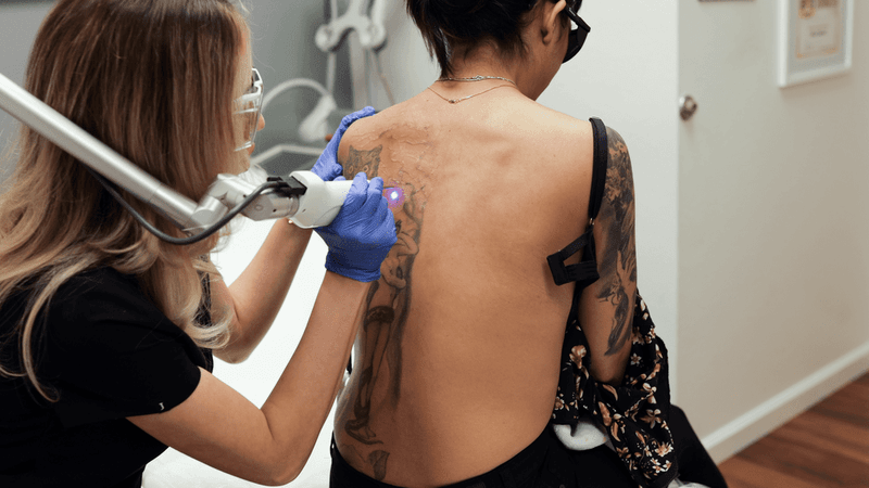 Delete Ink Laser Aesthetics