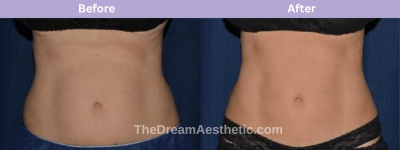 Dream Aesthetic Rejuvenation