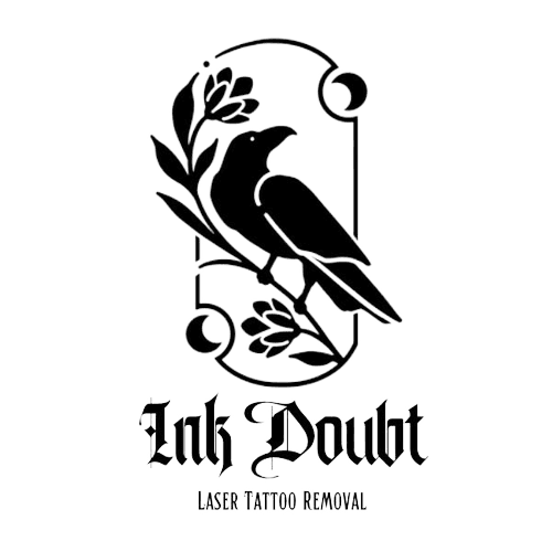 Ink Doubt Laser Tattoo Removal