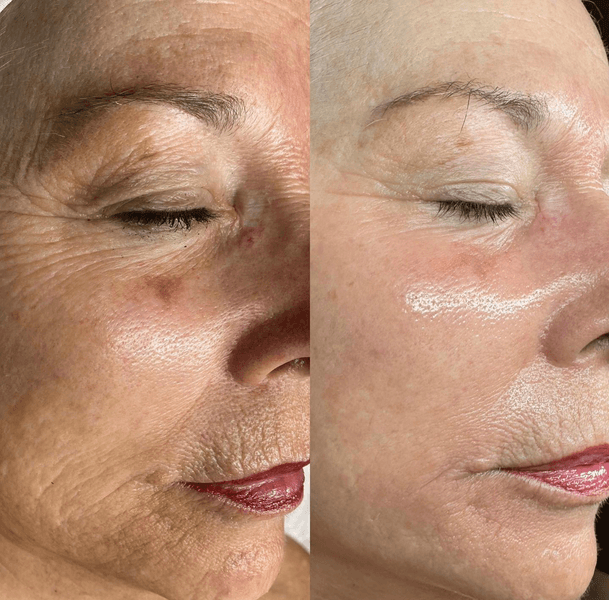 Loma Skin And Laser