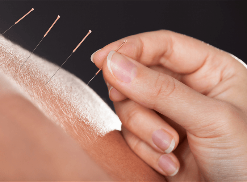 Love Acupuncture & Wellness Group