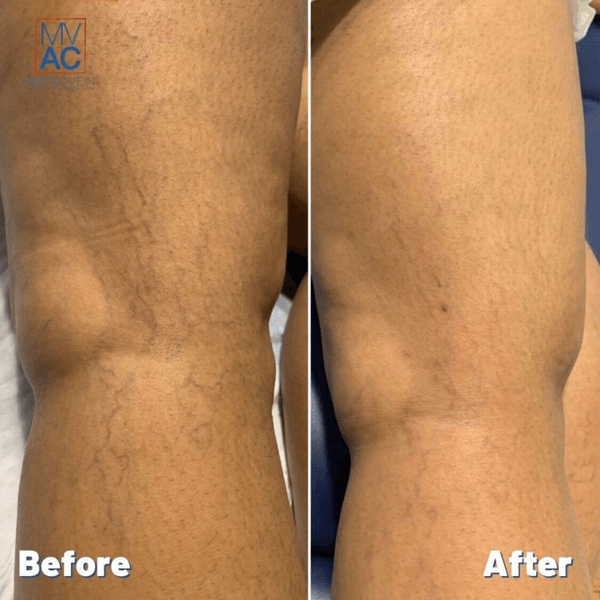 Metropolitan Vein and Aesthetic Center