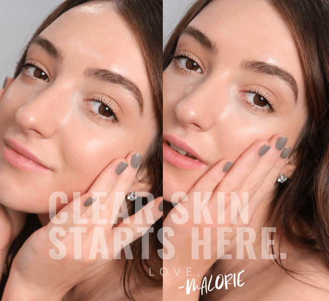 MM Skincare & Acne Clinic