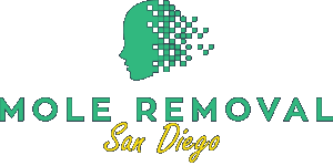 Mole Removal San Diego