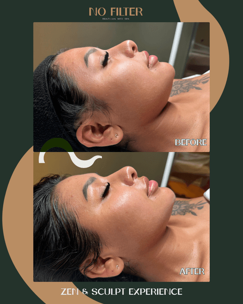 No Filter Brazilian Med Spa