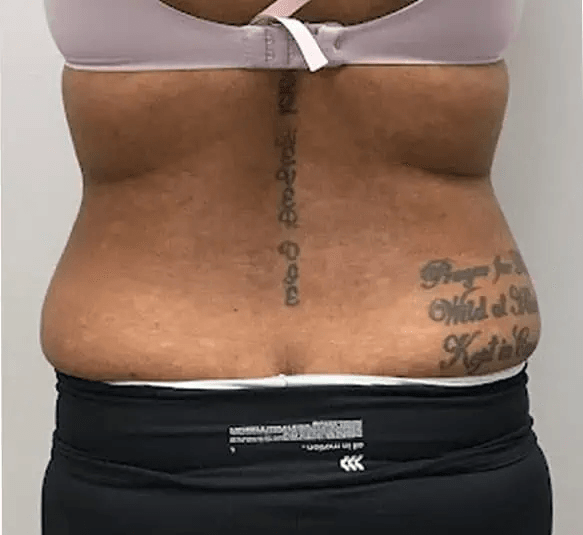 Park Avenue Aesthetics | Laser Hair Removal | Med Spa