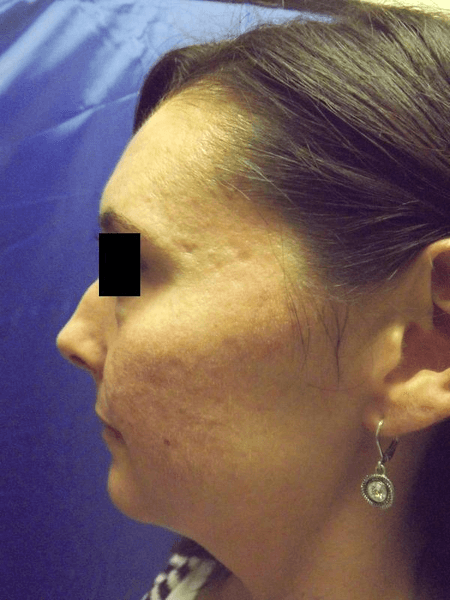 Premier Vein & Body by Schwartz