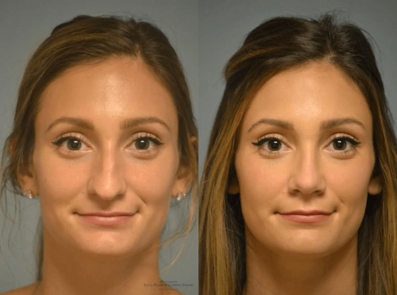 Providence Facial Plastic and Cosmetic Surgery
