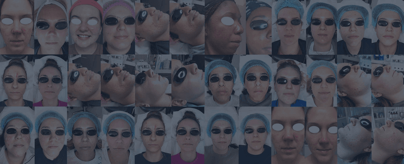 RaeDerma - Med Spa & Acne Clinic