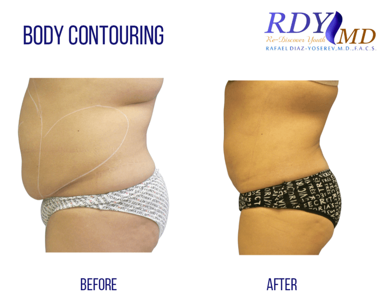 RDY MD Re-Discover Youth