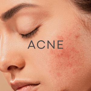 Same Week Tele-Dermatology