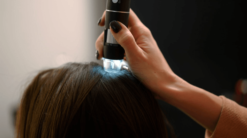 San Diego Hair Restoration