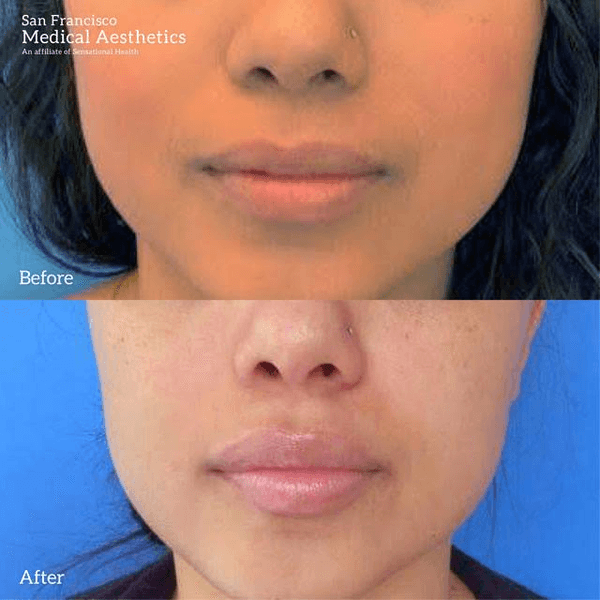 San Francisco Medical Aesthetics