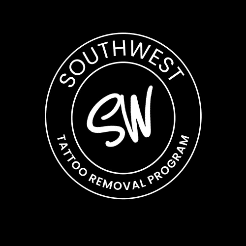 SouthWest Tattoo Removal Program