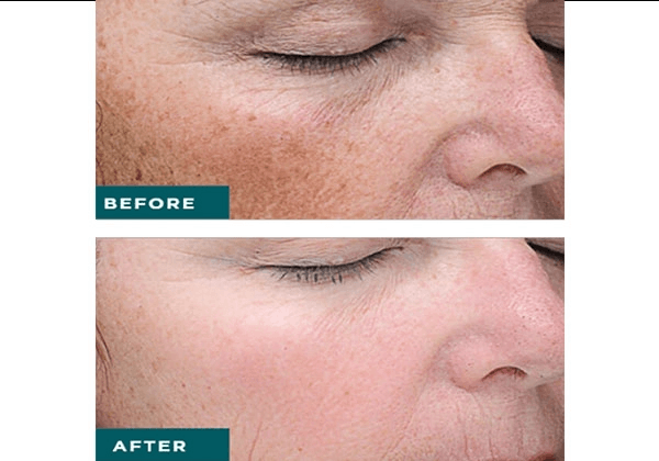 Tasneem Aziz Poonawalla Md