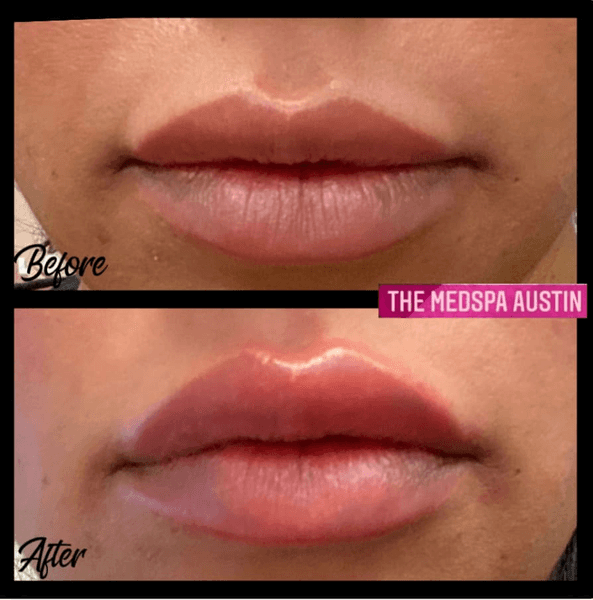 The Medspa Northwest Hills by Dr Jennifer Walden