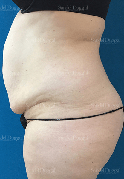 The Sandel Duggal Center For Plastic Surgery And Medspa