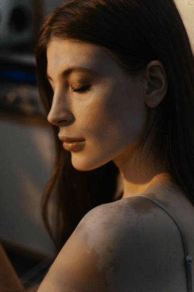 The Skin People