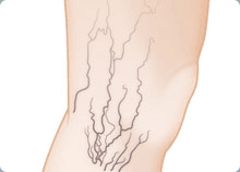 The Woodlands Regional Vein Center