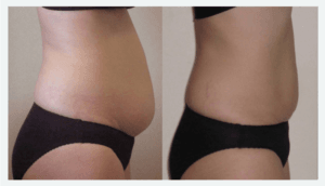 TrueCare Health and Wellness