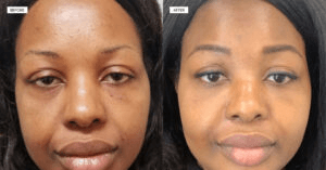 VivaSkin Dermatology And Aesthetics